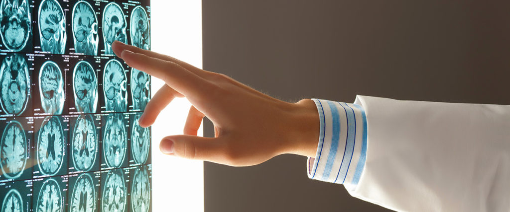 Doctor analyzing brain scan images for traumatic brain injury diagnosis