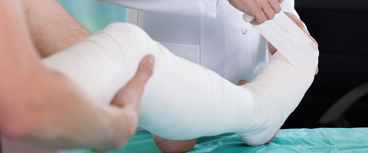 Doctor fixing cast on patients leg