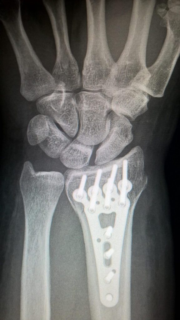 Seattle, WA Personal Injury Lawyers