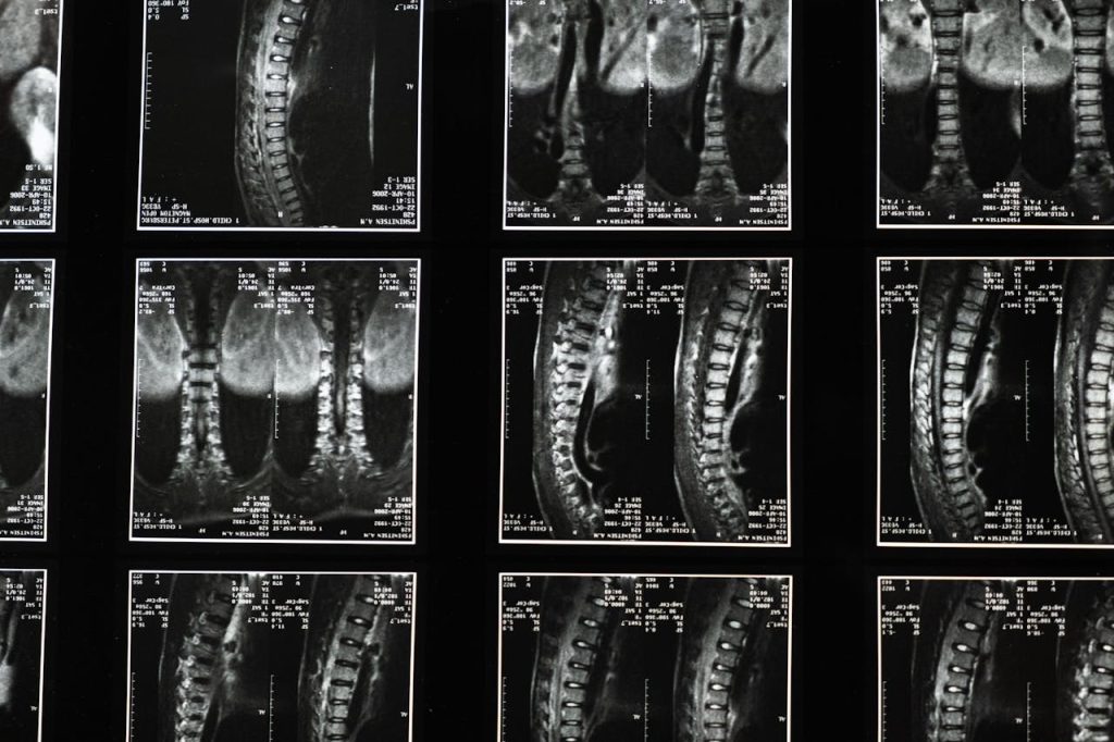 Understanding Back Injury Compensation and Damages